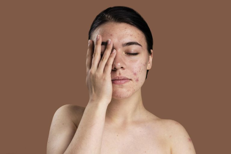 All About Common Skin Disorders